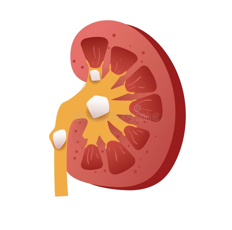 How to Get Rid of Kidney Stones Naturally? - jyovis