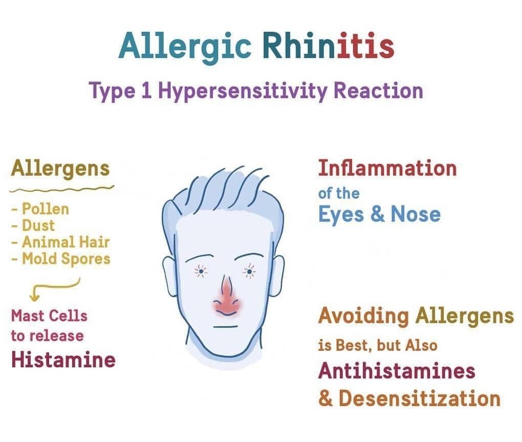 Allergic Rhinitis and Ayurveda jyovis